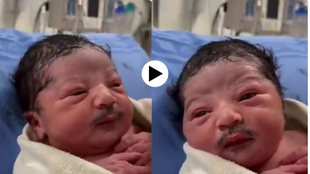 Viral Video: जन्मताच नवजात बाळाला चक्क मिशी अन् हनुवटीवर…! आई-बाबा म्हणाले…; VIDEO पाहून नेटकरी चक्रावले