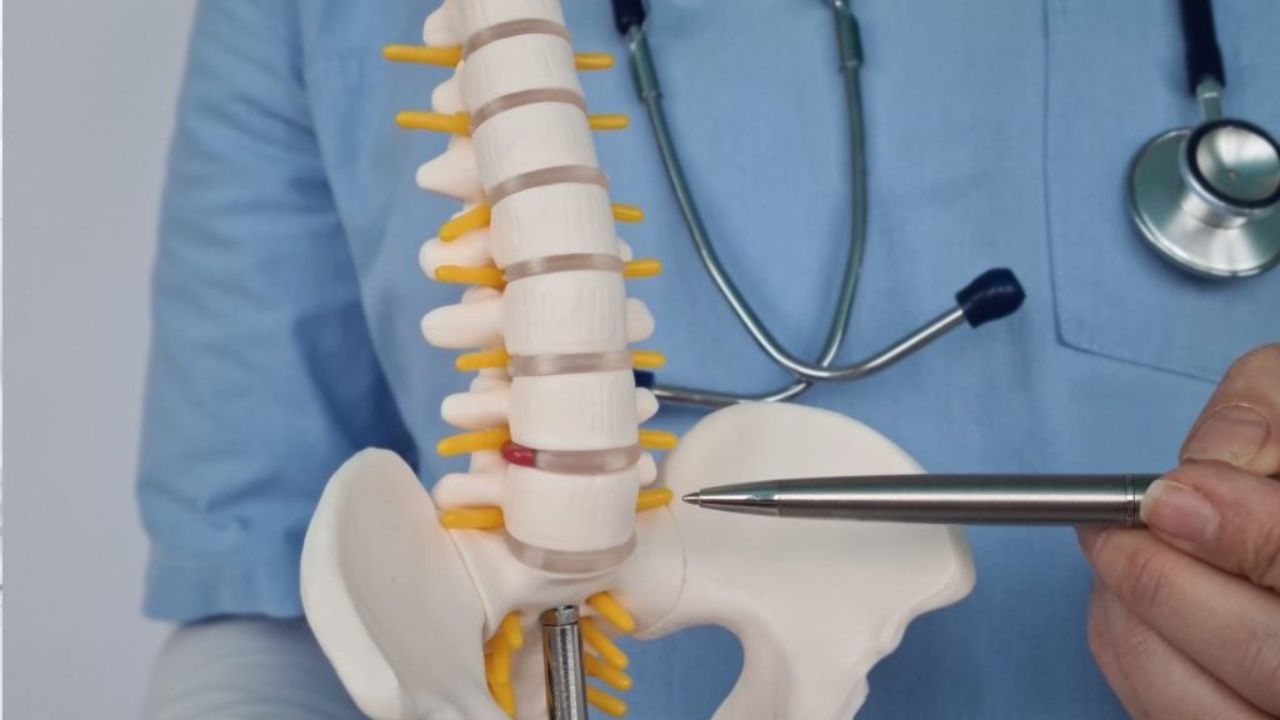 Spinal Fracture : 75 वर्षीय महिलेच्या पाठदुखीमागे ऑस्टिओपोरोसिसमुळे मणक्याचे फ्रॅक्चर; बलून किफोप्लास्टीने मिळाला तातडीचा आराम