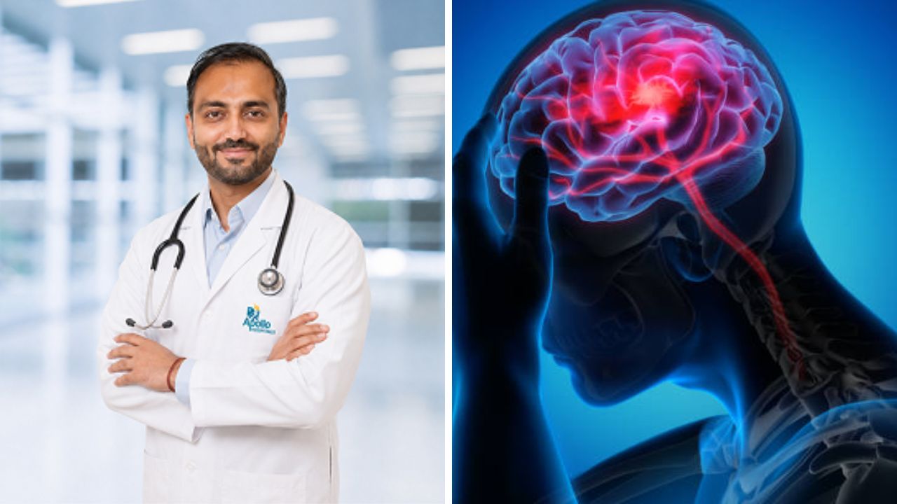 स्ट्रोकची धोक्याची लक्षणे अनेकदा दुर्लक्षित; आपत्कालीन उपचार घेण्यास विलंब न करण्याचे डॉक्टरांचे आवाहन