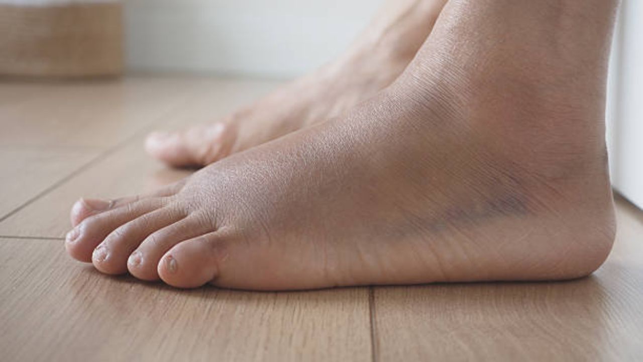 Health Care Tips: हातापायांना कायमच सूज येते? किडनीपासून हृदयापर्यंत ‘या’ कारणांमुळे पायाला येऊ शकते सूज