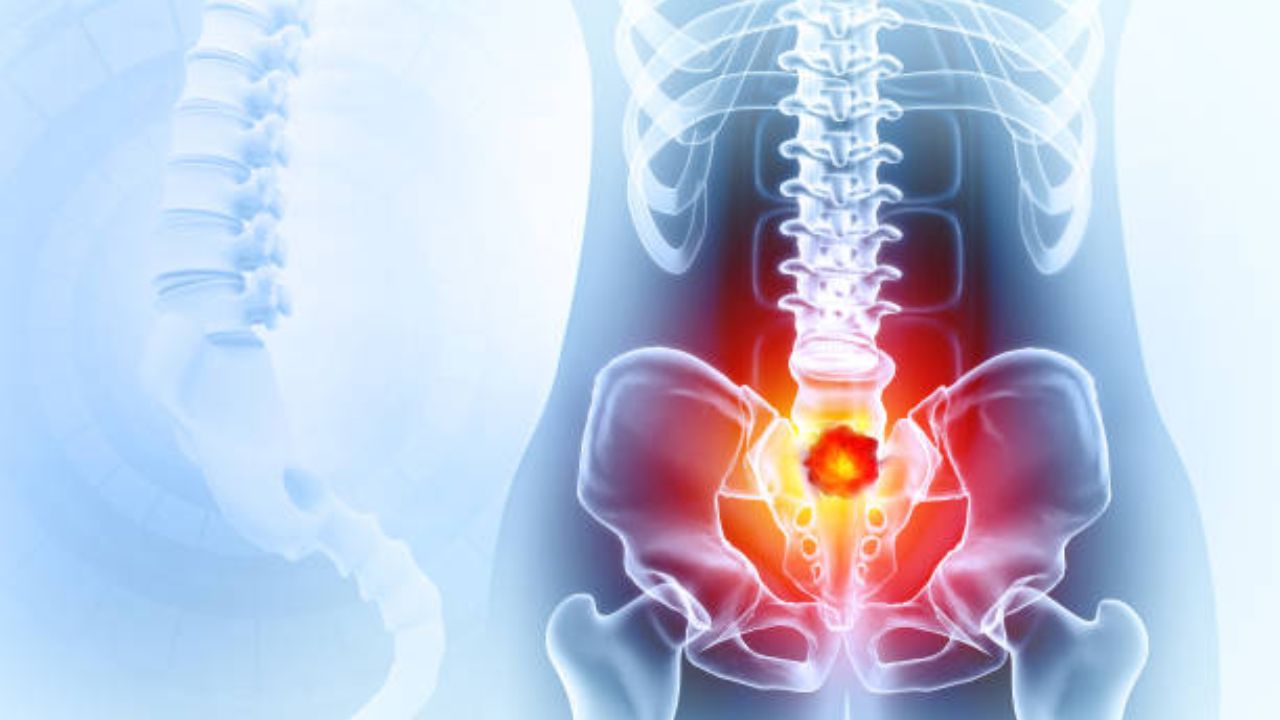 Sciatica Pain: सायटिकाची ‘ही’ लक्षणे दिसू लागल्यास अजिबात करू नका दुर्लक्ष, अन्यथा कायमच राहाल अंथरुणाला खिळून