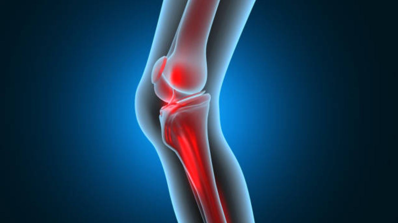 Bones Health: केवळ कॅल्शियमच्या कमतरतेमुळे नाहीतर ‘या’ कारणांमुळे हाडे होऊ शकतात ठिसूळ, जाणून घ्या सविस्तर
