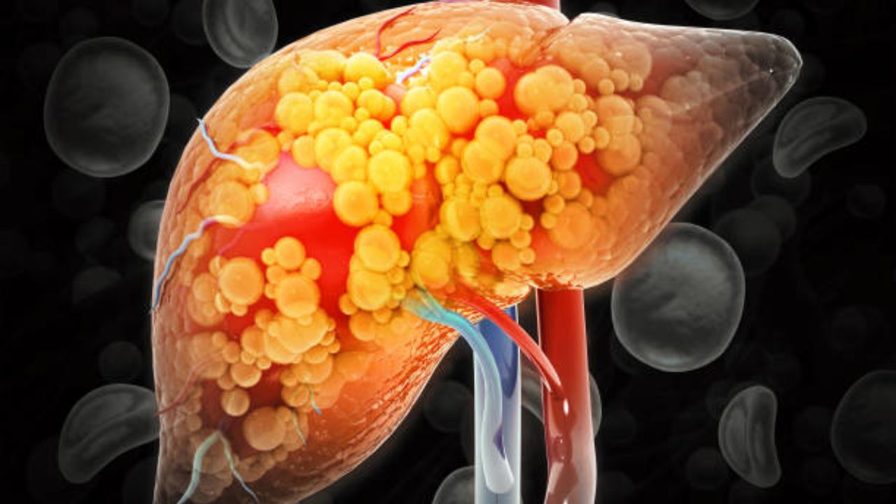 लिव्हरमध्ये जमा झालेली अनावश्यक चरबी कायमची होईल नष्ट! Liver Detox करण्यासाठी आहारात करा ‘या’ पेयांचा समावेश