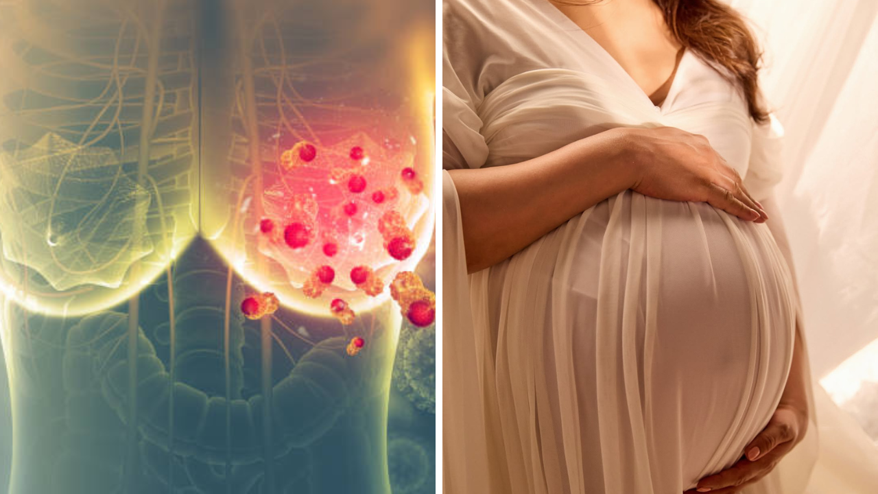 Pregnancy After Breast Cancer: ‘कर्करोगानंतरही आई होऊ शकेन का…’, प्रजनन क्षमता, गर्भधारणा आणि स्तनपान तज्ज्ञांचा योग्य सल्ला